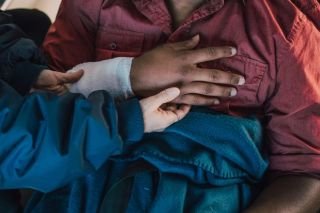 Chronic wounds report reveals misunderstanding